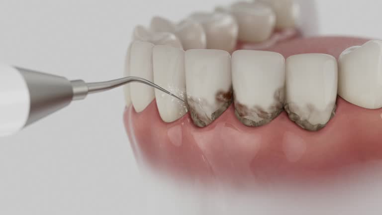 Trusted Teeth Cleaning And Checkup service in Lexington, MS - Dentist Open Now